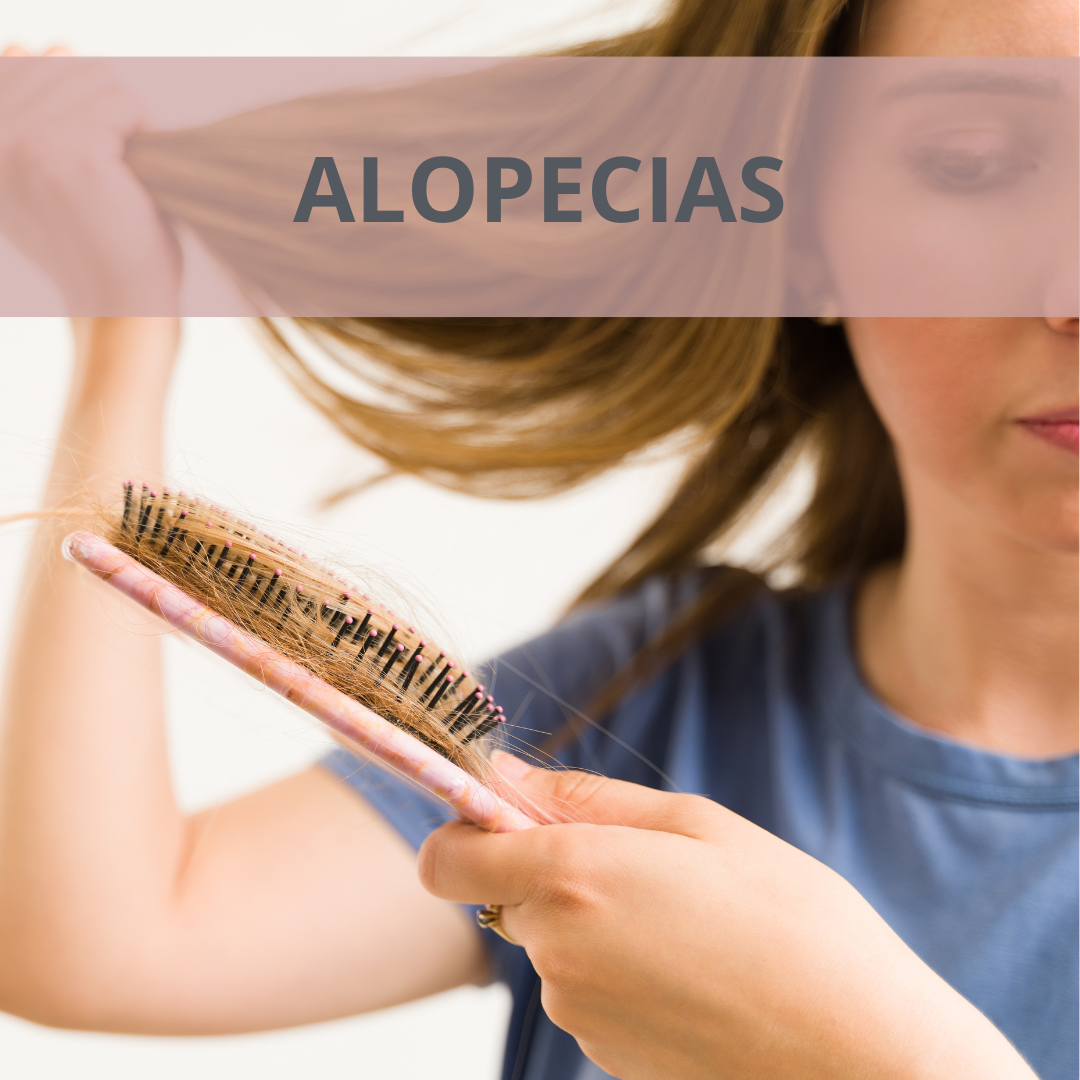 Alopecia