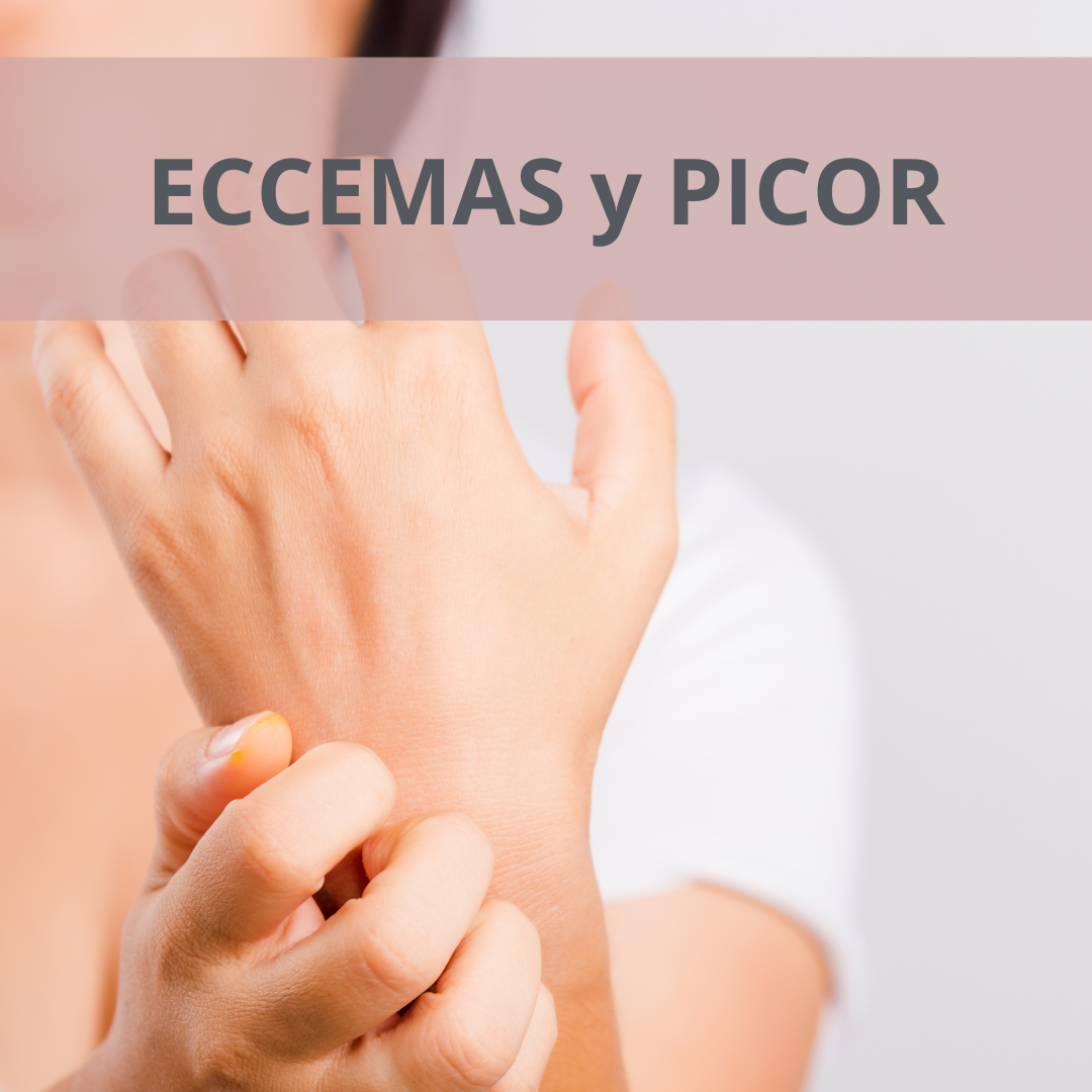 Eccema y picor