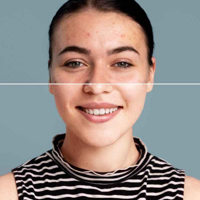 Dermatología general 2